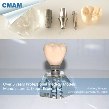 DH/13164, Tooth Implant Anatomy, Implant Model, 3 parts, Educational Teaching Anatomical Models
DH/13164, Tooth Implant Anatomy, Implant Model, 3 parts, Educational Teaching Anatomical Models