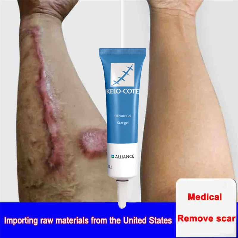 15g Scar Removal Cream Face Cream For Face Acne Scar Stretch Marks Remover Cream Skin Repair Face Cream Acne Spots Ba Ke
15g Scar Removal Cream Face Cream For Face Acne Scar Stretch Marks Remover Cream Skin Repair Face Cream Acne Spots Ba Ke