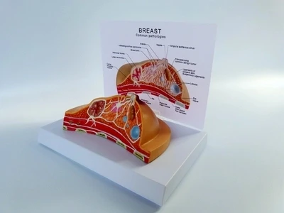 Breast common disease breast pathology anatomical model Have a disease, a lump, a cancerous Instruction board 16*13*12cm 
Breast common disease breast pathology anatomical model Have a disease, a lump, a cancerous Instruction board 16*13*12cm