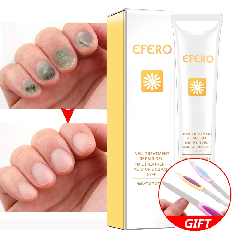 5PCS Nail Fungus Treatment Feet Care Essence Whitening Toe From Nail Foot Fungus Remove Gel Antifungal Onychomycosis Cream EFERO
5PCS Nail Fungus Treatment Feet Care Essence Whitening Toe From Nail Foot Fungus Remove Gel Antifungal Onychomycosis Cream EFERO