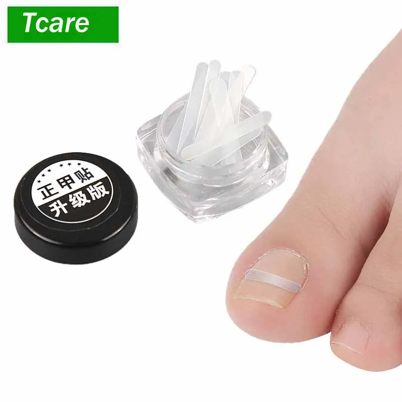 10Pcs/Set Foot Care Ingrown Toenail Pedicure Straightening Clip Toenails Correction Elastic Patches Foot Nail Care
10Pcs/Set Foot Care Ingrown Toenail Pedicure Straightening Clip Toenails Correction Elastic Patches Foot Nail Care