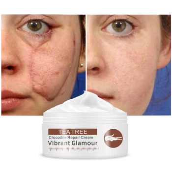 VIBRANT GLAMOUR Crocodile Scar Repair Facial Essence To Remove Acne Scars Stretch Marks Whitening Moisturizing Skin Care TSLM1
VIBRANT GLAMOUR Crocodile Scar Repair Facial Essence To Remove Acne Scars Stretch Marks Whitening Moisturizing Skin Care TSLM1
