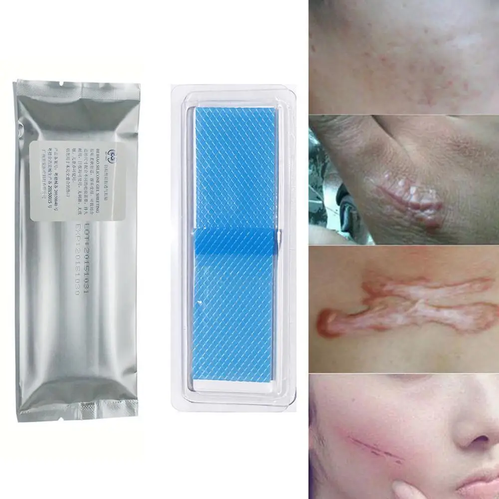 Silicone Removal Patch Reusable Acne Gel Scar Therapy Silicon Patch Remove Trauma Burn Sheet Skin Repair
Silicone Removal Patch Reusable Acne Gel Scar Therapy Silicon Patch Remove Trauma Burn Sheet Skin Repair
