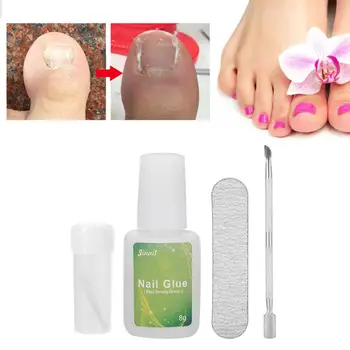 5Pcs Ingrown Toenail Correction Tool Paronychia Recover Toe Nail Fixer Corrector with Toenail Patch Nail Glue Pedicure Tool
5Pcs Ingrown Toenail Correction Tool Paronychia Recover Toe Nail Fixer Corrector with Toenail Patch Nail Glue Pedicure Tool