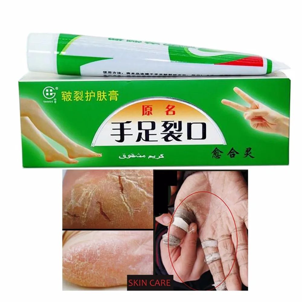 Hand Foot Crack Cream Heel Chapped Peeling Repair Anti Dry Crack Skin Chinese Medicinal Ointment Cream Skin Care
Hand Foot Crack Cream Heel Chapped Peeling Repair Anti Dry Crack Skin Chinese Medicinal Ointment Cream Skin Care