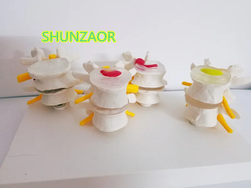 4-stages Human anatomy skeleton Spine model Disc Lumbar Vertebrae anatoma brain skull model medical instrume
4-stages Human anatomy skeleton Spine model Disc Lumbar Vertebrae anatoma brain skull model medical instrume