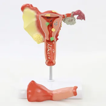 1:1 Human Uterus Anatomical Model Pathological Ovary Anatomical Model Female Uterus Anatomy Female Reproductive Anatomical Model
1:1 Human Uterus Anatomical Model Pathological Ovary Anatomical Model Female Uterus Anatomy Female Reproductive Anatomical Model