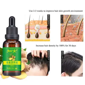Hair Growth Serum Ginger Shampoo Conditioner Natural Ingredients for All Hair Types Men Women Hairs Nutrition
Hair Growth Serum Ginger Shampoo Conditioner Natural Ingredients for All Hair Types Men Women Hairs Nutrition