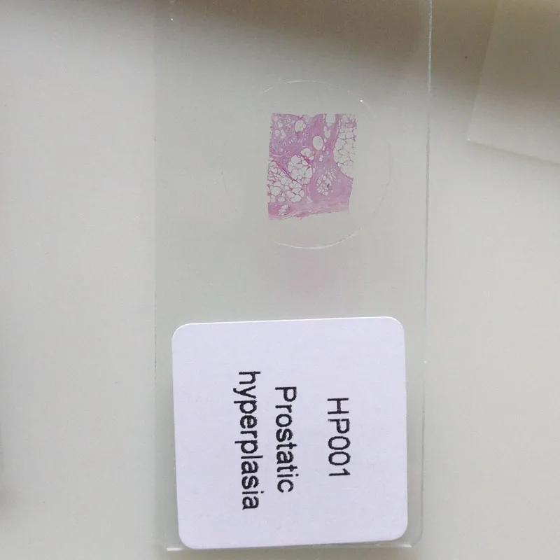 50pcs pathology slides 4