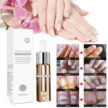 VIBRANTGLAMOUR Herbal Antibacterial Nail Treatments Essence liquid Nail Fungus Art Repair Foot Nail Care Improve Infection TSLM1
VIBRANTGLAMOUR Herbal Antibacterial Nail Treatments Essence liquid Nail Fungus Art Repair Foot Nail Care Improve Infection TSLM1