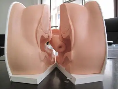 Female Contraceptive Guidance Uterus Model Gynecological Educational Teaching Model
Female Contraceptive Guidance Uterus Model Gynecological Educational Teaching Model