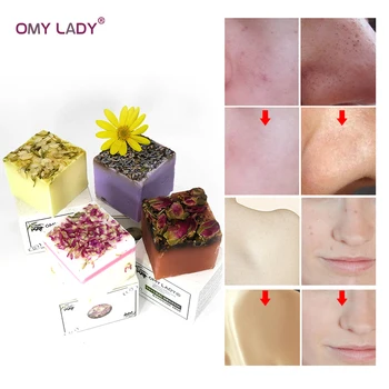OMY LADY Cooling Flower Handmade Soap 100% Pure Plant Essential Oil Soap for Bath Face Cleanser Deep Clean Moisturizing Skin
OMY LADY Cooling Flower Handmade Soap 100% Pure Plant Essential Oil Soap for Bath Face Cleanser Deep Clean Moisturizing Skin