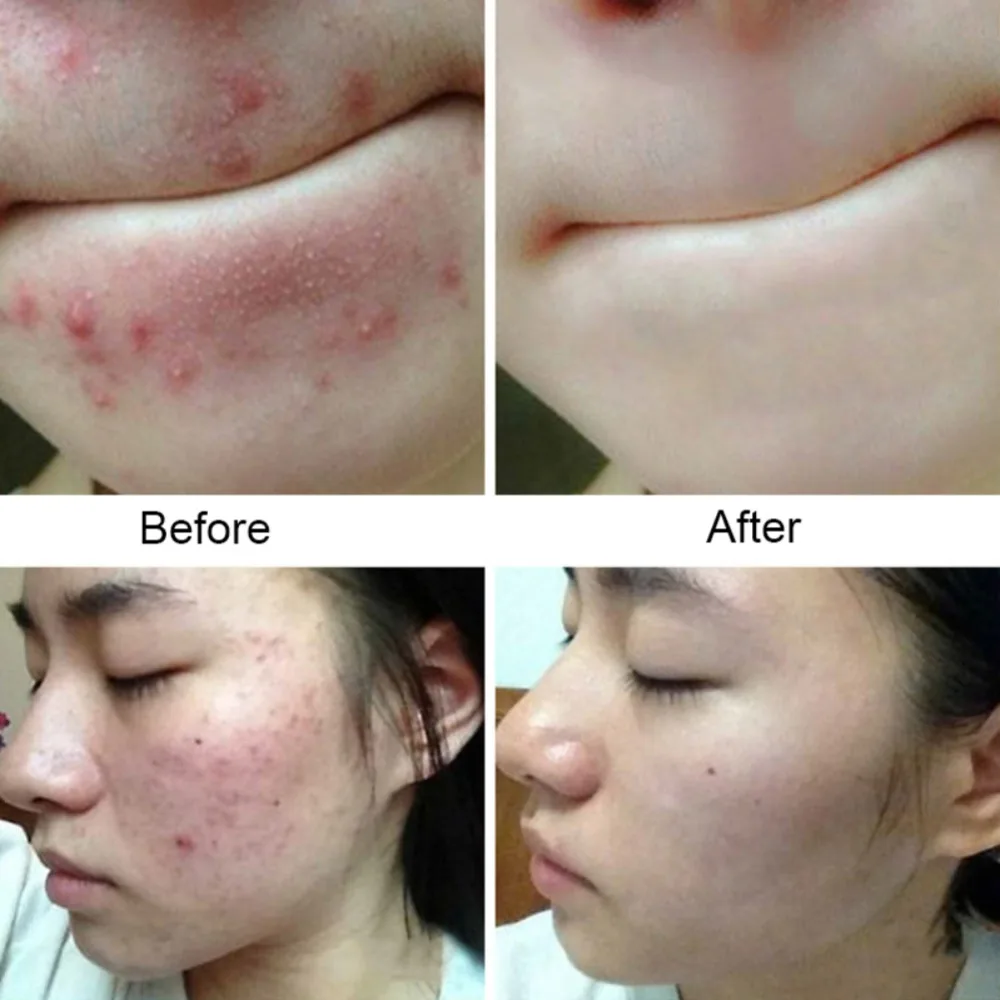 100g Sea Salt Soap Face Cleaner Removal Pimple Pores Acne Treatment Goat Milk Moisturizing For Face Wash Soap Savon Au Sapone
100g Sea Salt Soap Face Cleaner Removal Pimple Pores Acne Treatment Goat Milk Moisturizing For Face Wash Soap Savon Au Sapone