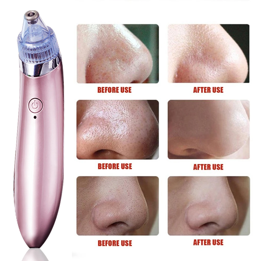 Electric Vacuum Pore Cleaner Blackhead Vacuum Suction Acne Clean Exfoliating Cleansing Comedo Suction Pore Cleaner Dropshipping
Electric Vacuum Pore Cleaner Blackhead Vacuum Suction Acne Clean Exfoliating Cleansing Comedo Suction Pore Cleaner Dropshipping