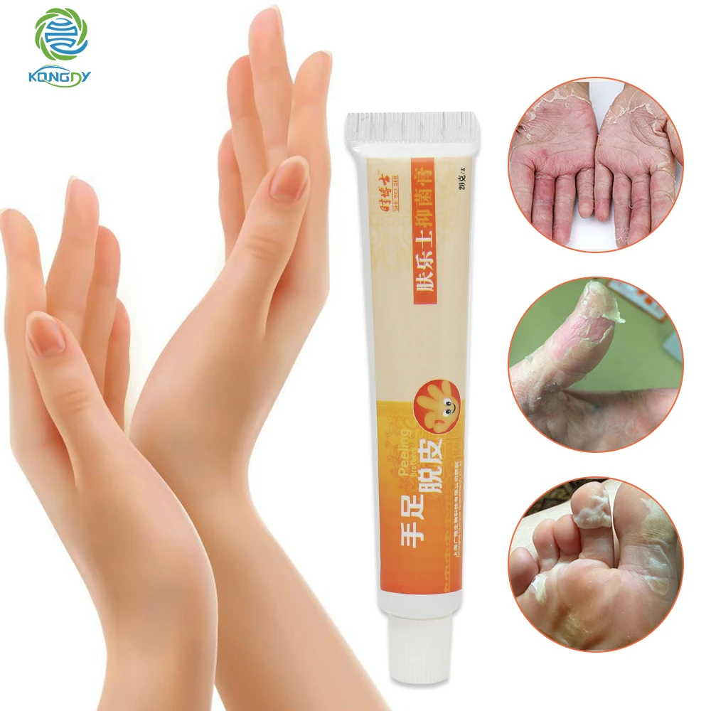 KONGDY Feet Dead Skin Removal Ointment Hands Foot Peeling Cream Moist Calluses Removal Heel Chapped Peeling Repair Frostbite
KONGDY Feet Dead Skin Removal Ointment Hands Foot Peeling Cream Moist Calluses Removal Heel Chapped Peeling Repair Frostbite