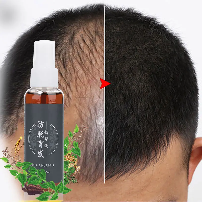 100ml Chinese Medicine Hair Fiber Applicator Hair Building Fiber Anti Loss Oil Styling Extension Thinning Thickening Hair Growth
100ml Chinese Medicine Hair Fiber Applicator Hair Building Fiber Anti Loss Oil Styling Extension Thinning Thickening Hair Growth