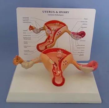 Uterus & Ovary Female genital uterus model vaginal ovary pathological changes obstetric structure teaching aids
Uterus & Ovary Female genital uterus model vaginal ovary pathological changes obstetric structure teaching aids
