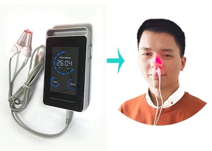 Allergic Rhinitis Low Level Soft Laser Therapy Nose Pain Control Medical Device for Personal Use
Allergic Rhinitis Low Level Soft Laser Therapy Nose Pain Control Medical Device for Personal Use