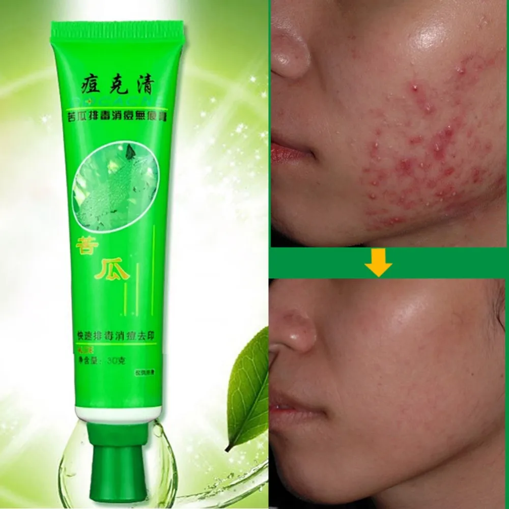 30g Acne Treatment Blackhead Remova Anti Acne Cream Oil Control Shrink Pores Acne Scar Remove Face Care Whitening
30g Acne Treatment Blackhead Remova Anti Acne Cream Oil Control Shrink Pores Acne Scar Remove Face Care Whitening