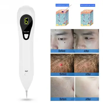 LCD Pro Mole Freckle Removal Pen Three Levels Adjustable Spot Tattoo Remover Facial Freckle Tag Wart Removal Skin Care Tool
LCD Pro Mole Freckle Removal Pen Three Levels Adjustable Spot Tattoo Remover Facial Freckle Tag Wart Removal Skin Care Tool