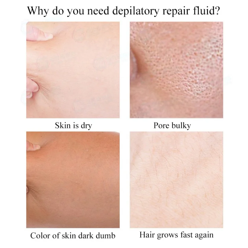 Smooth Body Hair Removal Spray Pre After Wax Treatment Liquid