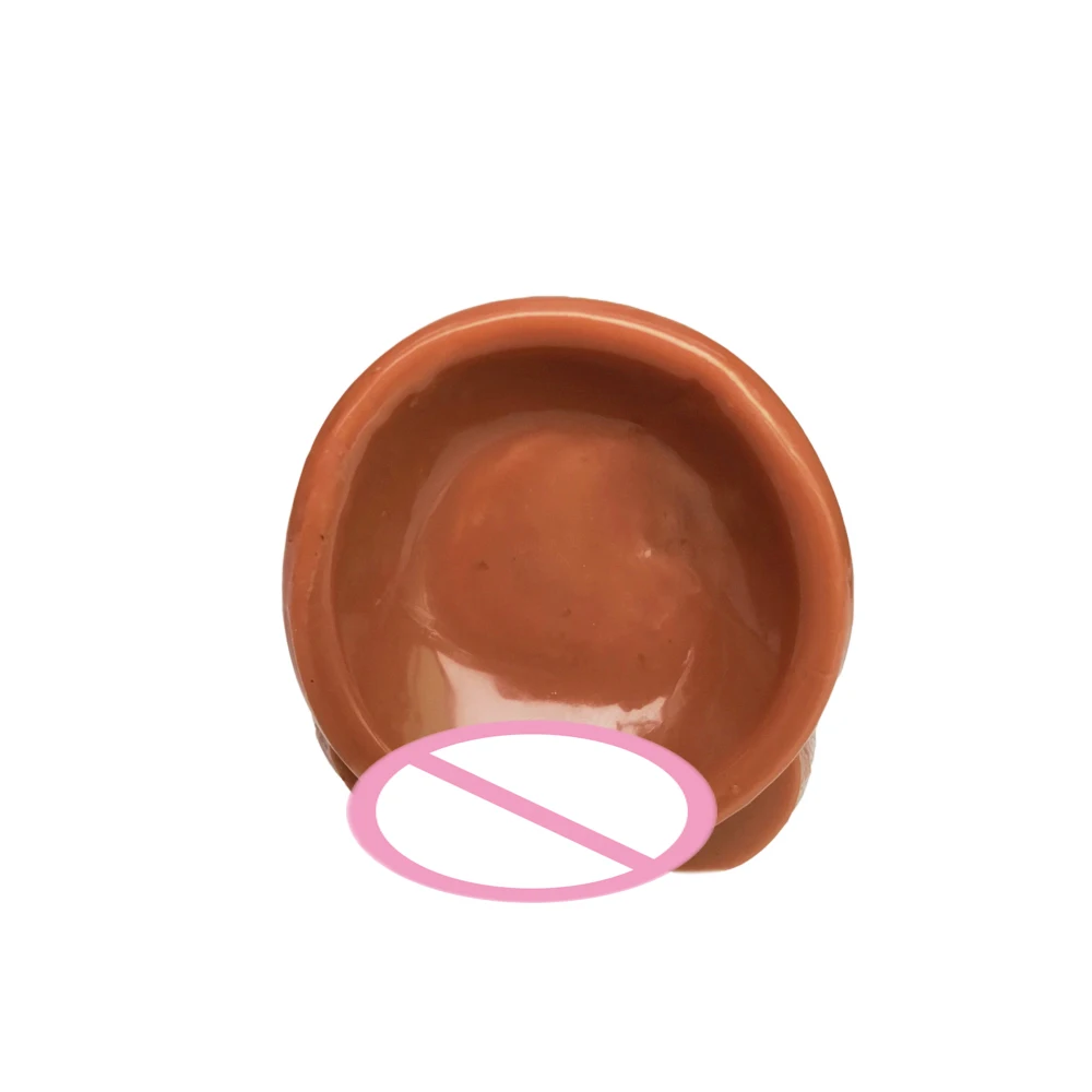1 (10)