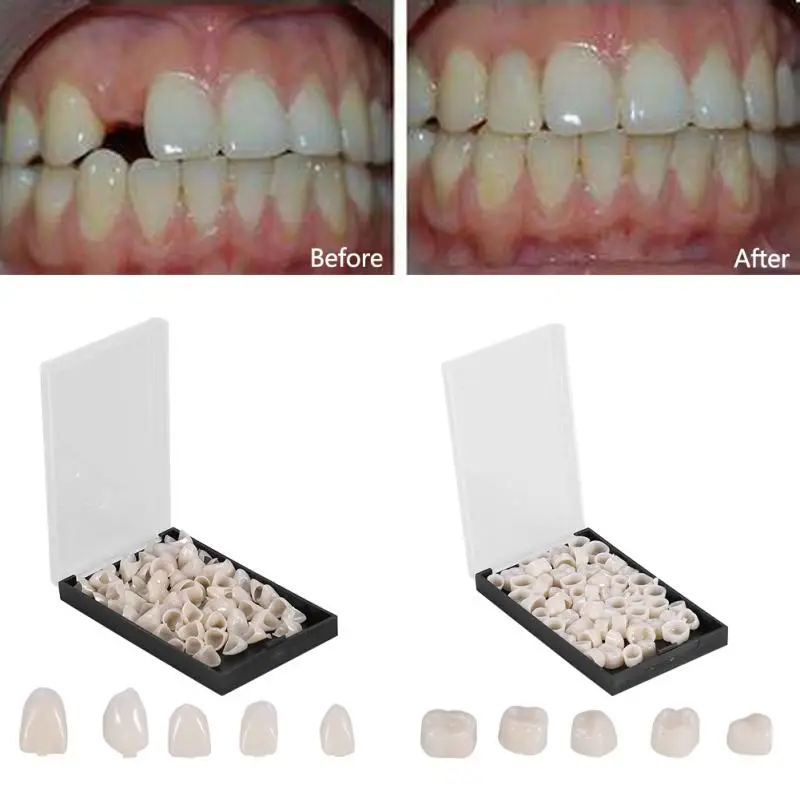 50Pcs/Box Dental Crowns Resin Porcelain Temporary Teeth Crown Oral Care Anterior Molar Crown Teeth Whitening
50Pcs/Box Dental Crowns Resin Porcelain Temporary Teeth Crown Oral Care Anterior Molar Crown Teeth Whitening