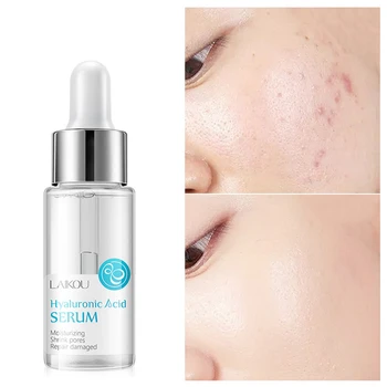 Deep Moisturizer Face Serum Liquid Hyaluronic Acid Shrink Pores Repair Facial Rejuvenation Skin Care Korean
Deep Moisturizer Face Serum Liquid Hyaluronic Acid Shrink Pores Repair Facial Rejuvenation Skin Care Korean