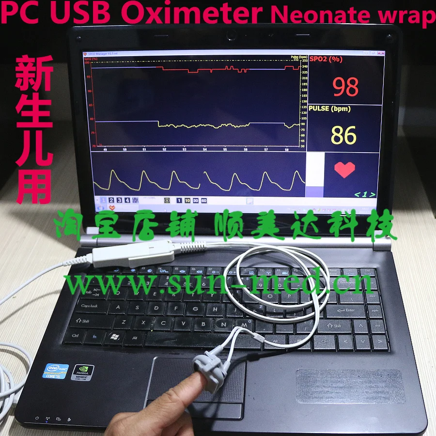 USB Oximeter PC based Pulse Oximeter SpO2 monitor usb probe (1 cable + 1 Neonate wrap sensor ) 24 hour monitoring
USB Oximeter PC based Pulse Oximeter SpO2 monitor usb probe (1 cable + 1 Neonate wrap sensor ) 24 hour monitoring