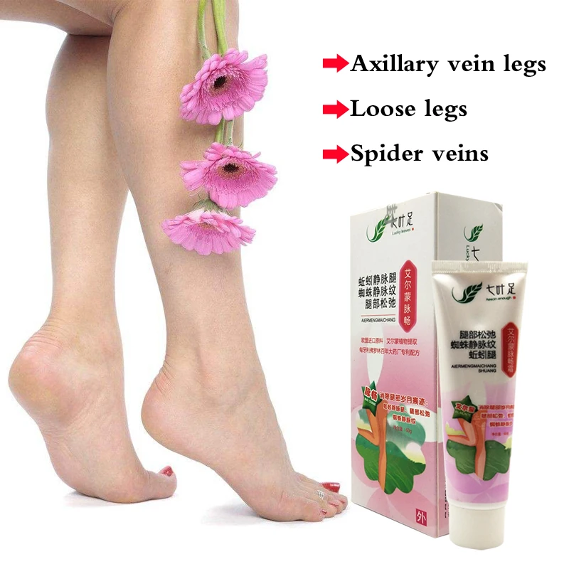 Varicose Veins Treatment Cream Earthworms leg Vasculitis Angiitis Cure Patch Natural Solution Herbal Angiitis Ointment
Varicose Veins Treatment Cream Earthworms leg Vasculitis Angiitis Cure Patch Natural Solution Herbal Angiitis Ointment
