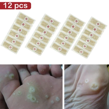 12pcs Medical Plaster Foot Corn Removal Warts Thorn patch Corn of foot Calluses Callosity Detox clavus Medical Patch