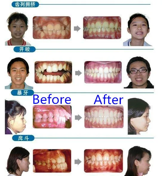 HTB1f8vMGFXXXXX.aXXXq6xXFXXXb