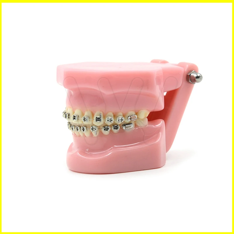 Dental Orthodontics Typodont Teeth Model Metal Brace bracket Typodont with Arch Wire
Dental Orthodontics Typodont Teeth Model Metal Brace bracket Typodont with Arch Wire
