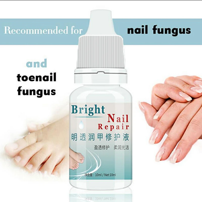 1 PCS 10ml Nail Fungus Onychomycosis Removal Treatment Finger Repair Recover Gloss Accelerate Nails Metabolism
1 PCS 10ml Nail Fungus Onychomycosis Removal Treatment Finger Repair Recover Gloss Accelerate Nails Metabolism