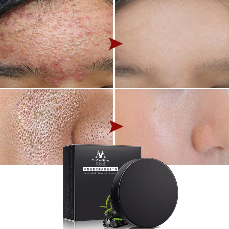 Meiyanqiong face cleansing soap black head acne remover oil control peeling dead skin Bamboo charcoal face scrub sope MY007
Meiyanqiong face cleansing soap black head acne remover oil control peeling dead skin Bamboo charcoal face scrub sope MY007