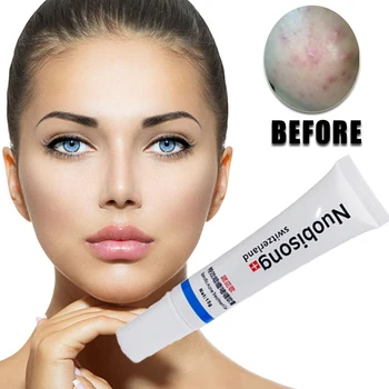 3pcs/lot Nuobisong Specific Acne Treatment Gel, Face care effectively remove pimples without irritating
3pcs/lot Nuobisong Specific Acne Treatment Gel, Face care effectively remove pimples without irritating