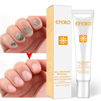 Hand Foot Protector Nails Repair Serum Nail Care Tools Anti Toenail Fungus Nails Nourishing Cream
Hand Foot Protector Nails Repair Serum Nail Care Tools Anti Toenail Fungus Nails Nourishing Cream