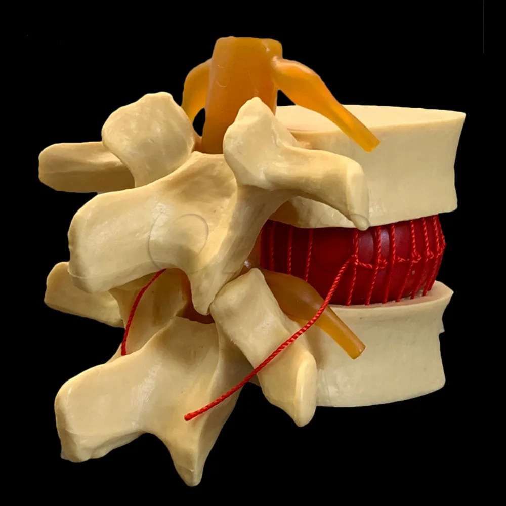 Human anatomy skeleton Spine Lumbar Disc Herniation Teaching Model brain skull traumatic pistol school supplies medical instrume
Human anatomy skeleton Spine Lumbar Disc Herniation Teaching Model brain skull traumatic pistol school supplies medical instrume