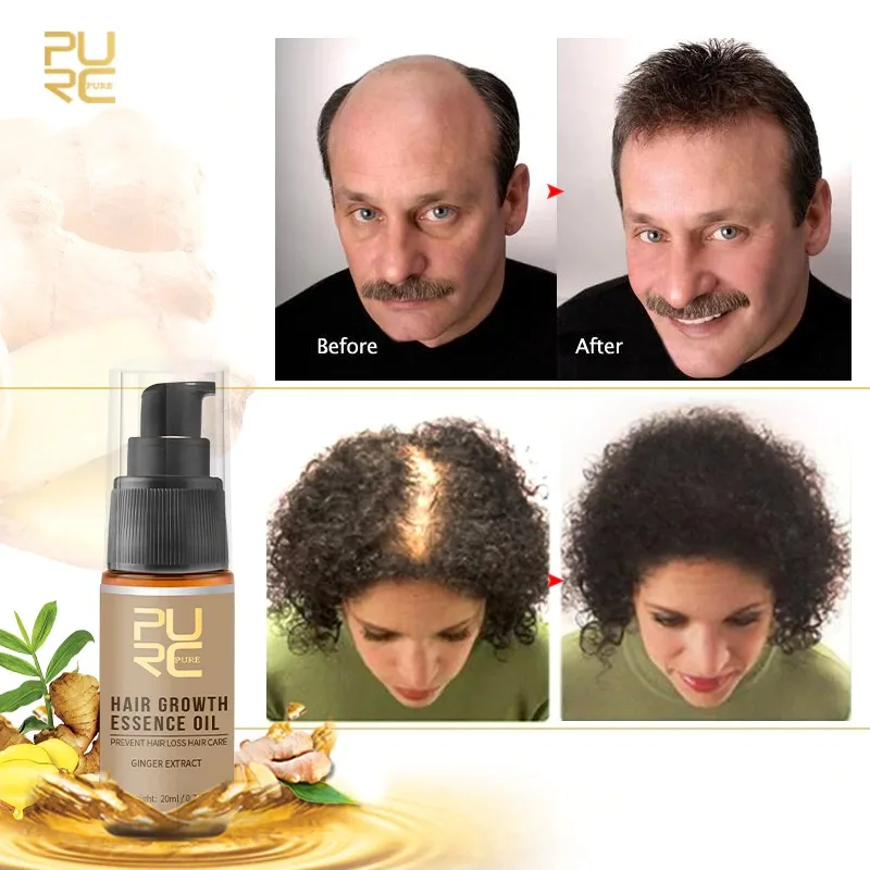 PURC New 1pcs Fast Hair Growth Essence Oil Hair Loss Treatment Help for Hairs Growth Hairs Care 20ml Professional High Quality
PURC New 1pcs Fast Hair Growth Essence Oil Hair Loss Treatment Help for Hairs Growth Hairs Care 20ml Professional High Quality