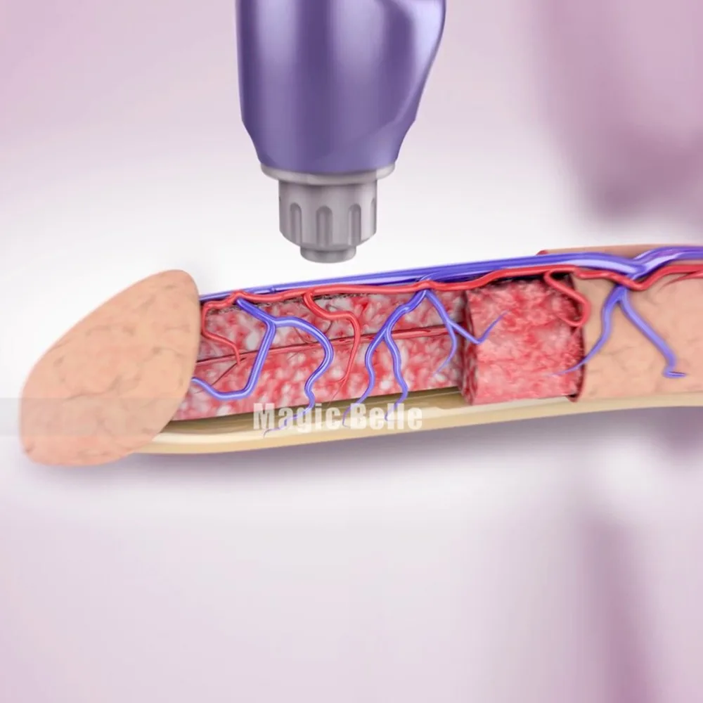 Видео Секса С Вакуумно Волновой Вибратором