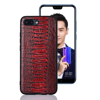 Phone Cover For Huawei Honor 10 V10 Ostrich Foot Texture Genuine Leather Case Mobile Phone Rear Cover For Huawei Honor 10 V10
Phone Cover For Huawei Honor 10 V10 Ostrich Foot Texture Genuine Leather Case Mobile Phone Rear Cover For Huawei Honor 10 V10