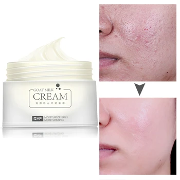 Goat Oil Moisturizing Face Cream HyaluronicAcid MoisturizerAnti WrinkleAnti Aging Nourishing Collagen Serum Day Cream Skin
Goat Oil Moisturizing Face Cream HyaluronicAcid MoisturizerAnti WrinkleAnti Aging Nourishing Collagen Serum Day Cream Skin