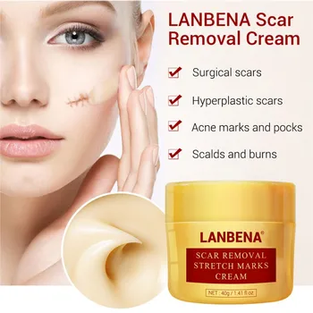 Scar Removal Cream Face Cream Skin Repair Face Cream Acne Spots Acne Treatment Blackhead Whitening Cream Skin Care
Scar Removal Cream Face Cream Skin Repair Face Cream Acne Spots Acne Treatment Blackhead Whitening Cream Skin Care