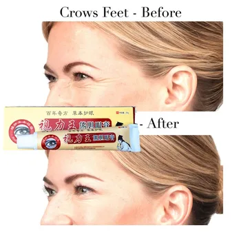 MIYUELENI Skin Firming Anti allergy Eye Essence for anti redness tightening finelines
MIYUELENI Skin Firming Anti allergy Eye Essence for anti redness tightening finelines