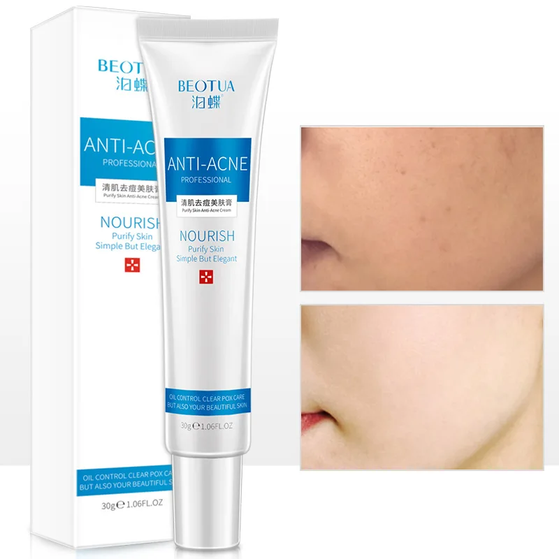30g Face Scream Whitening skin care anti acne treatment cream oil control Moisturizing Acne Scar Remover Pores acne cream
30g Face Scream Whitening skin care anti acne treatment cream oil control Moisturizing Acne Scar Remover Pores acne cream