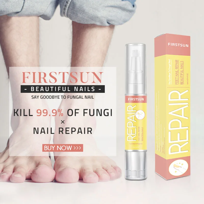 Nail Fungal Treatment Anti Fungus Onychomycosis Removal Toenail Care Nails Repair Liquid HS11
Nail Fungal Treatment Anti Fungus Onychomycosis Removal Toenail Care Nails Repair Liquid HS11
