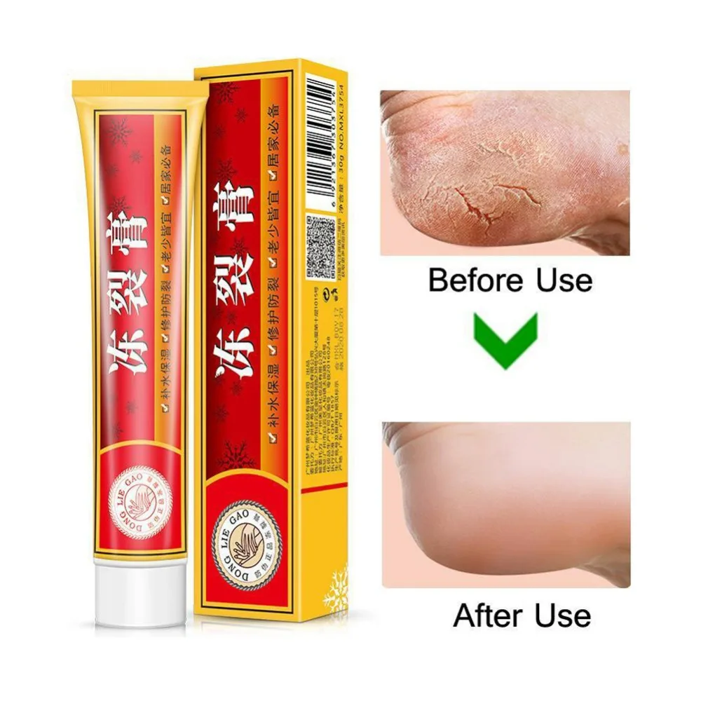 Useful Foot Cream Anti-Chapping Skin Repairing Moisturizer For Rough Dry And Cracked Chapped Feet Heel Foot Care Tool
Useful Foot Cream Anti-Chapping Skin Repairing Moisturizer For Rough Dry And Cracked Chapped Feet Heel Foot Care Tool