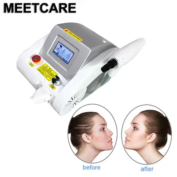 1064nm 532nm 1320nm ND Nd Yag Laser Tattoo Removal Face Massager Tatoo&Eyebrow Removal Laser Tattoo Machine With Red Pointed
1064nm 532nm 1320nm ND Nd Yag Laser Tattoo Removal Face Massager Tatoo&Eyebrow Removal Laser Tattoo Machine With Red Pointed