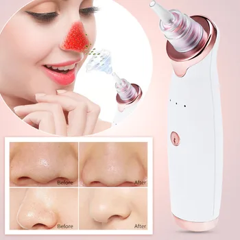4 In 1 Vacuum Electric Blackhead Inhaler Removal Pore Cleaner Skin Acne Spot Cutin Face Deep Cleansing Device Black Head 2Colors
4 In 1 Vacuum Electric Blackhead Inhaler Removal Pore Cleaner Skin Acne Spot Cutin Face Deep Cleansing Device Black Head 2Colors