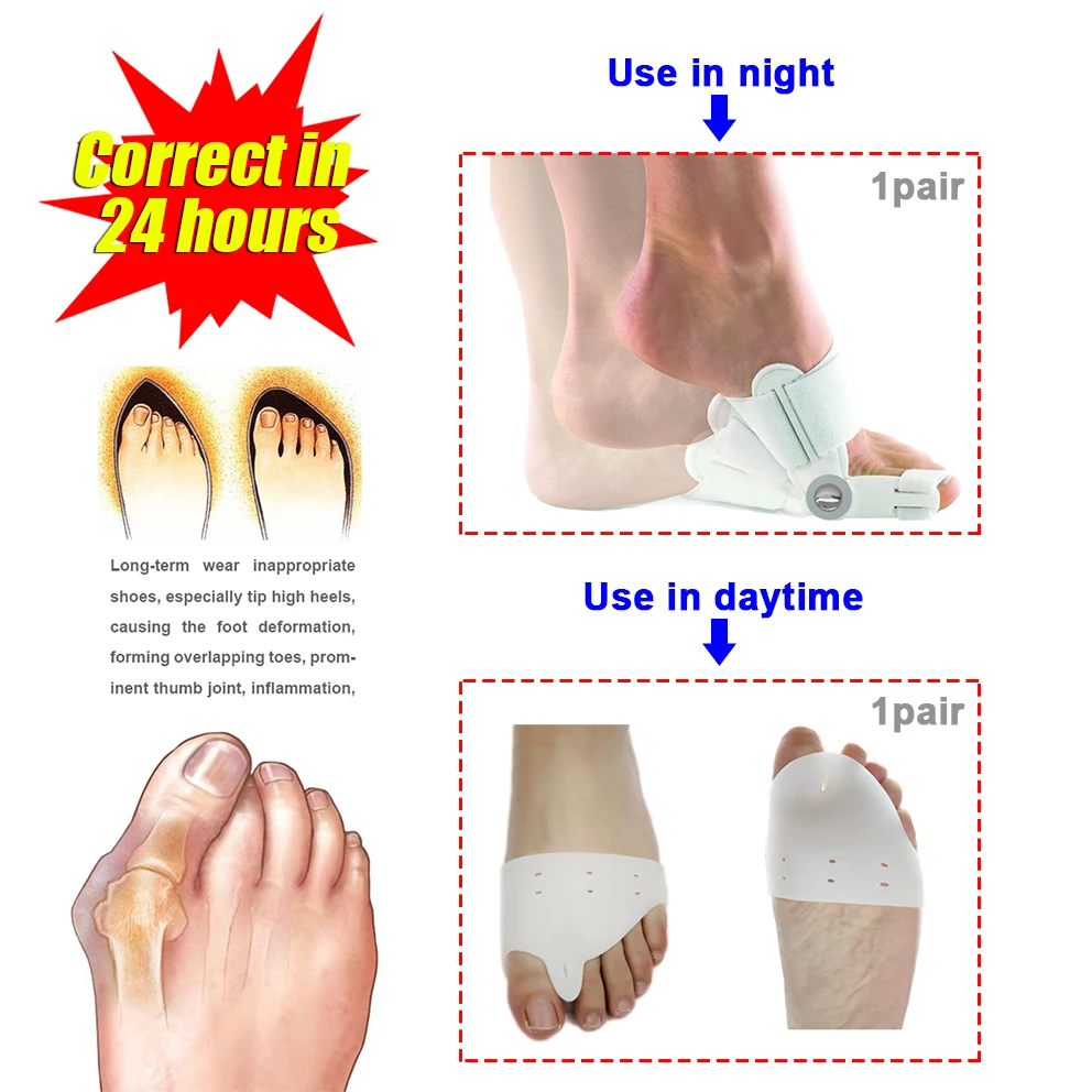 (1set=1pair night use + 1pair daytime use) Toes Care Foot Thumb The Big Toe Separator Hallux Valgus Toes Support Toe Corrector
(1set=1pair night use + 1pair daytime use) Toes Care Foot Thumb The Big Toe Separator Hallux Valgus Toes Support Toe Corrector